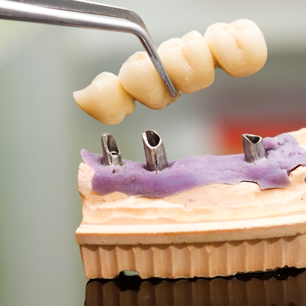 Model of lower jaw and bridge