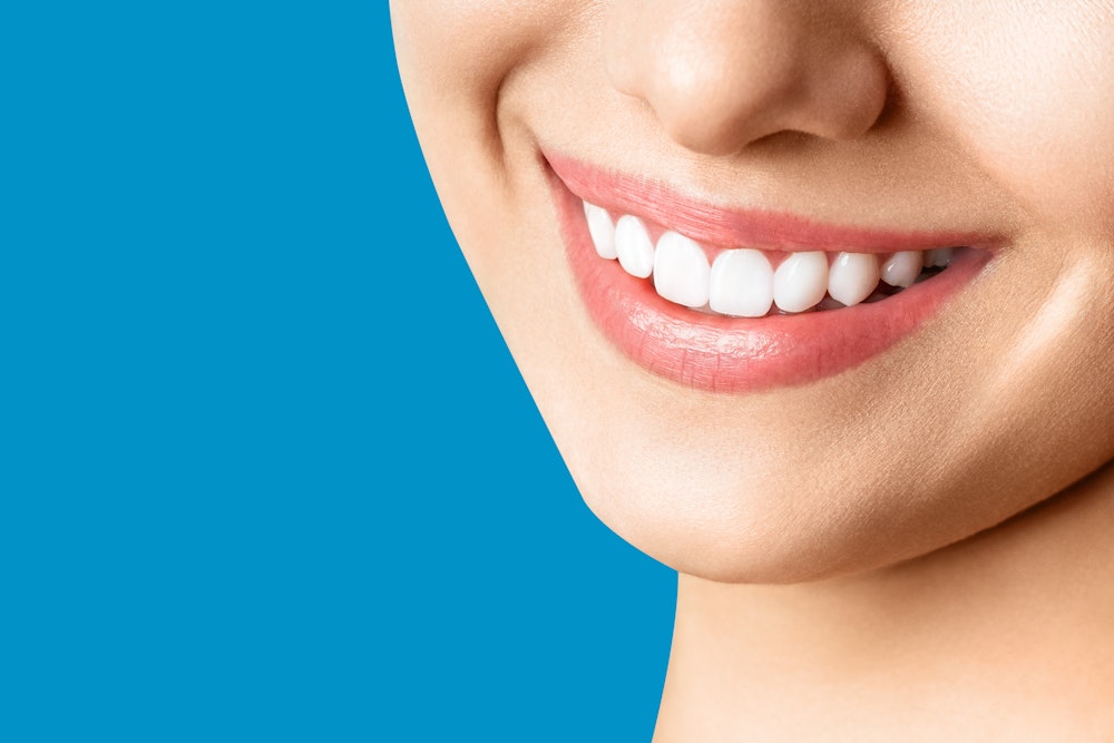 Close-up of a cosmetic dentistry patient's smile