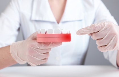 Dentist pointing to a model showing gum disease