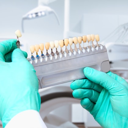 Dentist holding a tooth shade scale