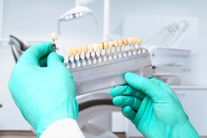 Dentist holding a tooth shade scale