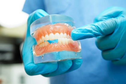 Dentist pointing at a dental model with missing teeth