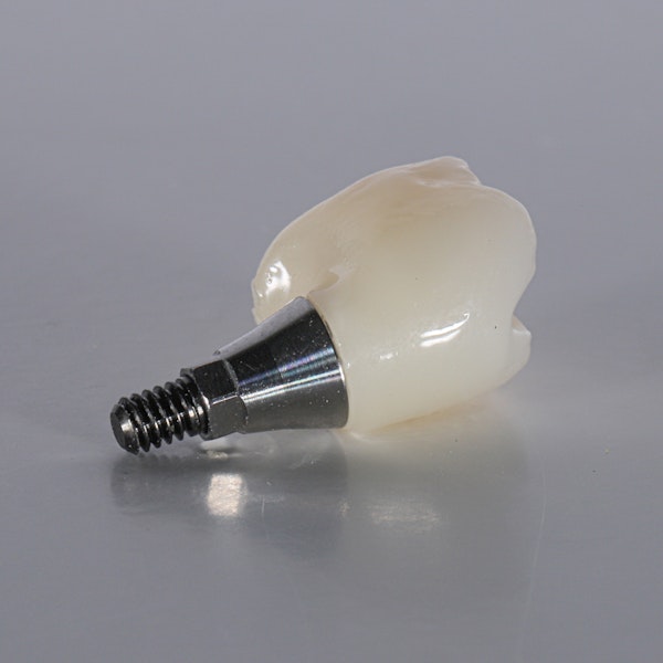 dental implant
