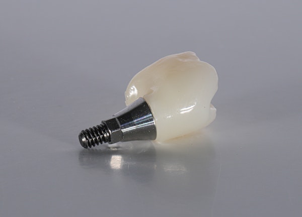 dental implant