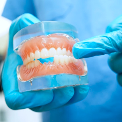 Dentist pointing at a dental model with missing teeth