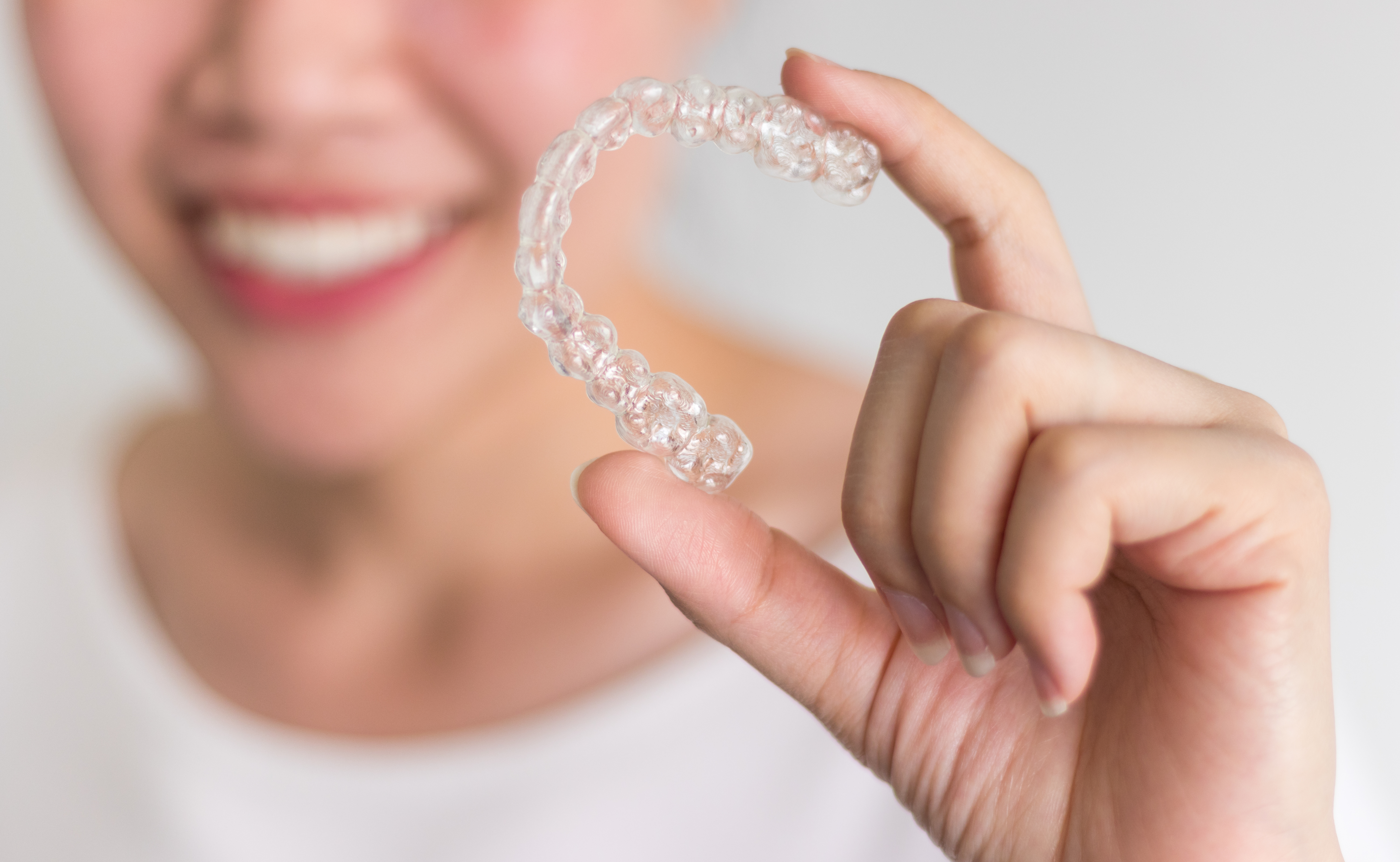 clear aligners