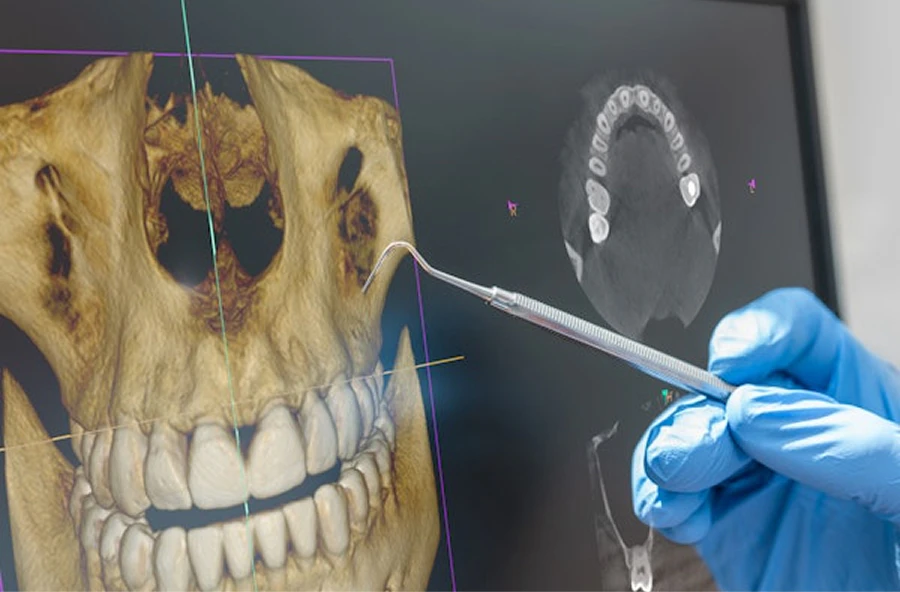 Digital x-rays