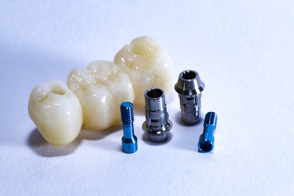 Implant-Supported Bridges