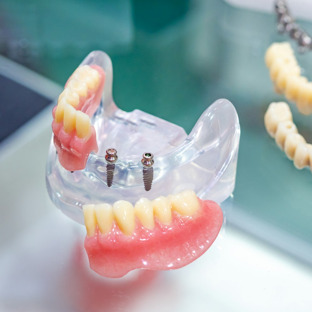 Mini Dental Implants
