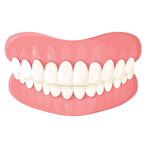 Overbite illustration