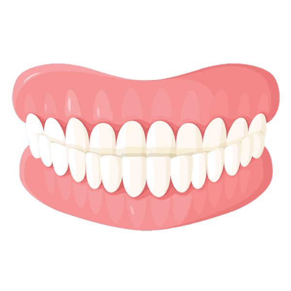 Underbite illustration