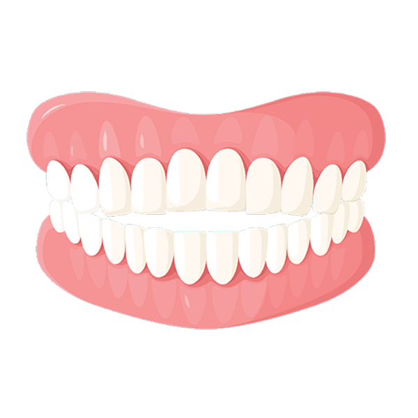 open bite illustration