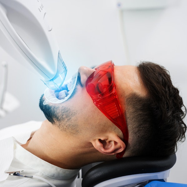 Man getting her teeth professionally whitened