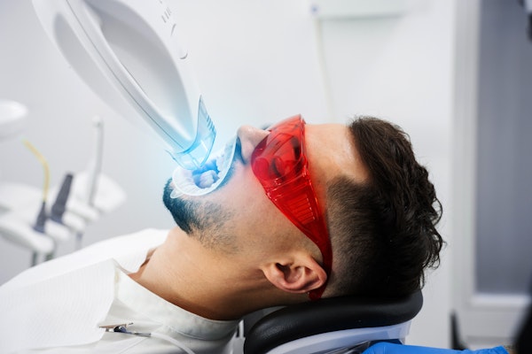Man getting her teeth professionally whitened