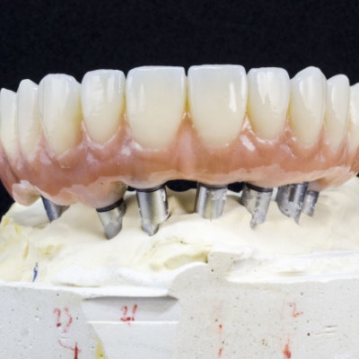 closeup shot of an implant-supported denture