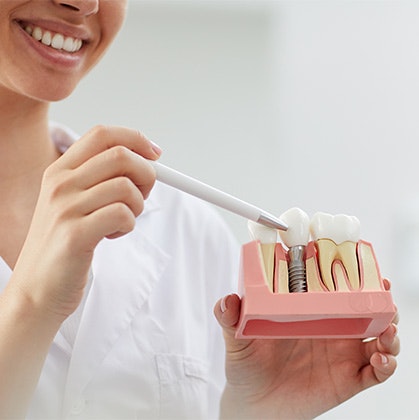 Dentist showing a model of a dental implant