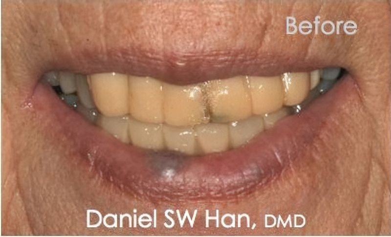 Dr. Daniel Han's patient before dentistry