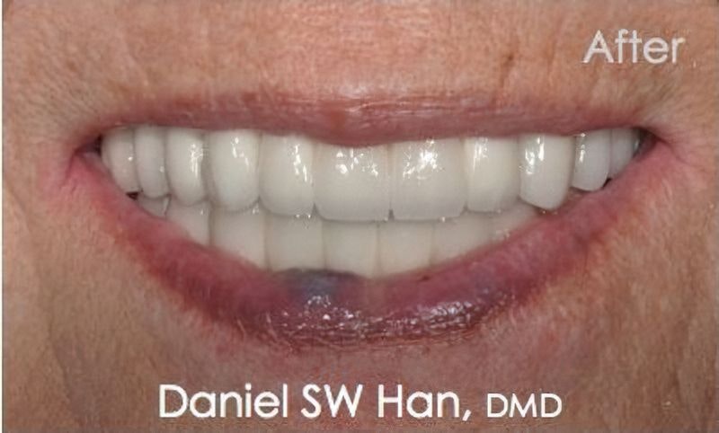 Dr. Daniel Han's after dentistry