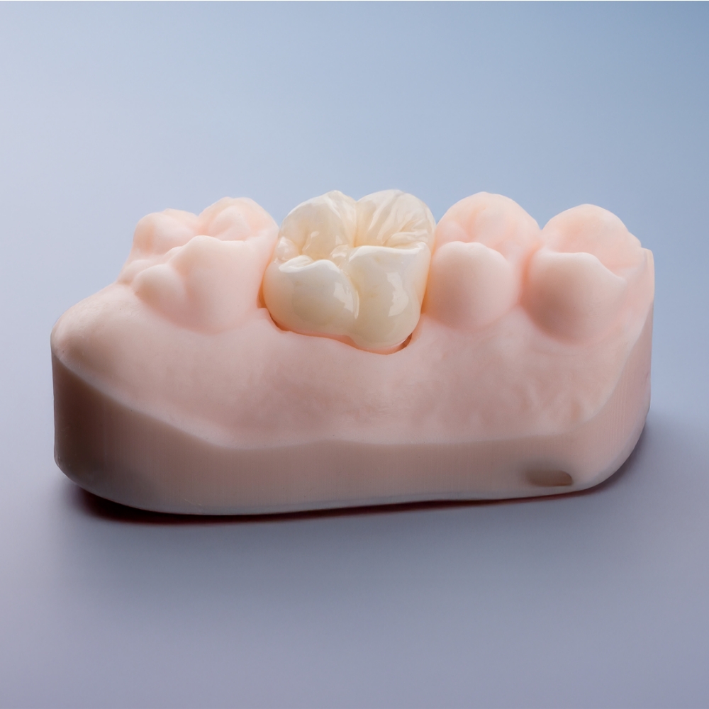 Dental Crown