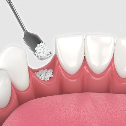 Illustration of dental surgery
