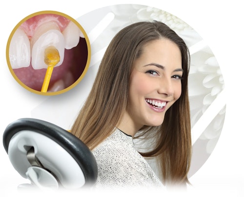 Murray Hill woman in dental chair and the veneers process