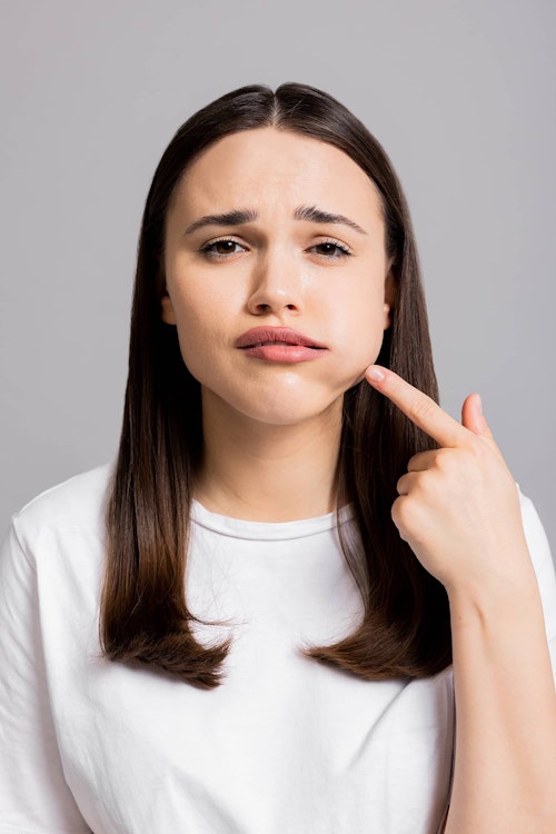 Woman with swollen jaw who needs root canal therapy