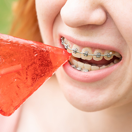 person with braces biting into a hard lollipop