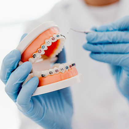 model of teeth with braces