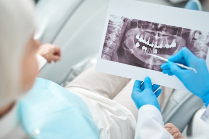 dentist and patient looking at x-ray