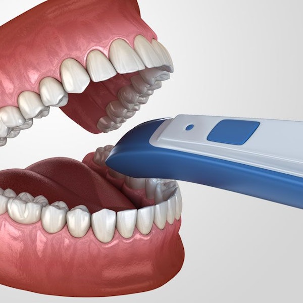 Digital scanner illustration