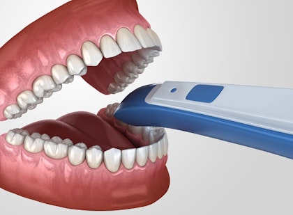 Digital scanner illustration