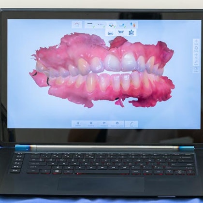 Digital smile on laptop