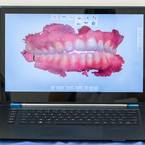 Digital smile on laptop