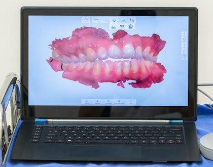 Digital smile on laptop