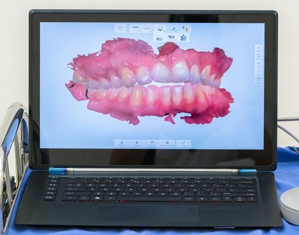 Digital smile on laptop