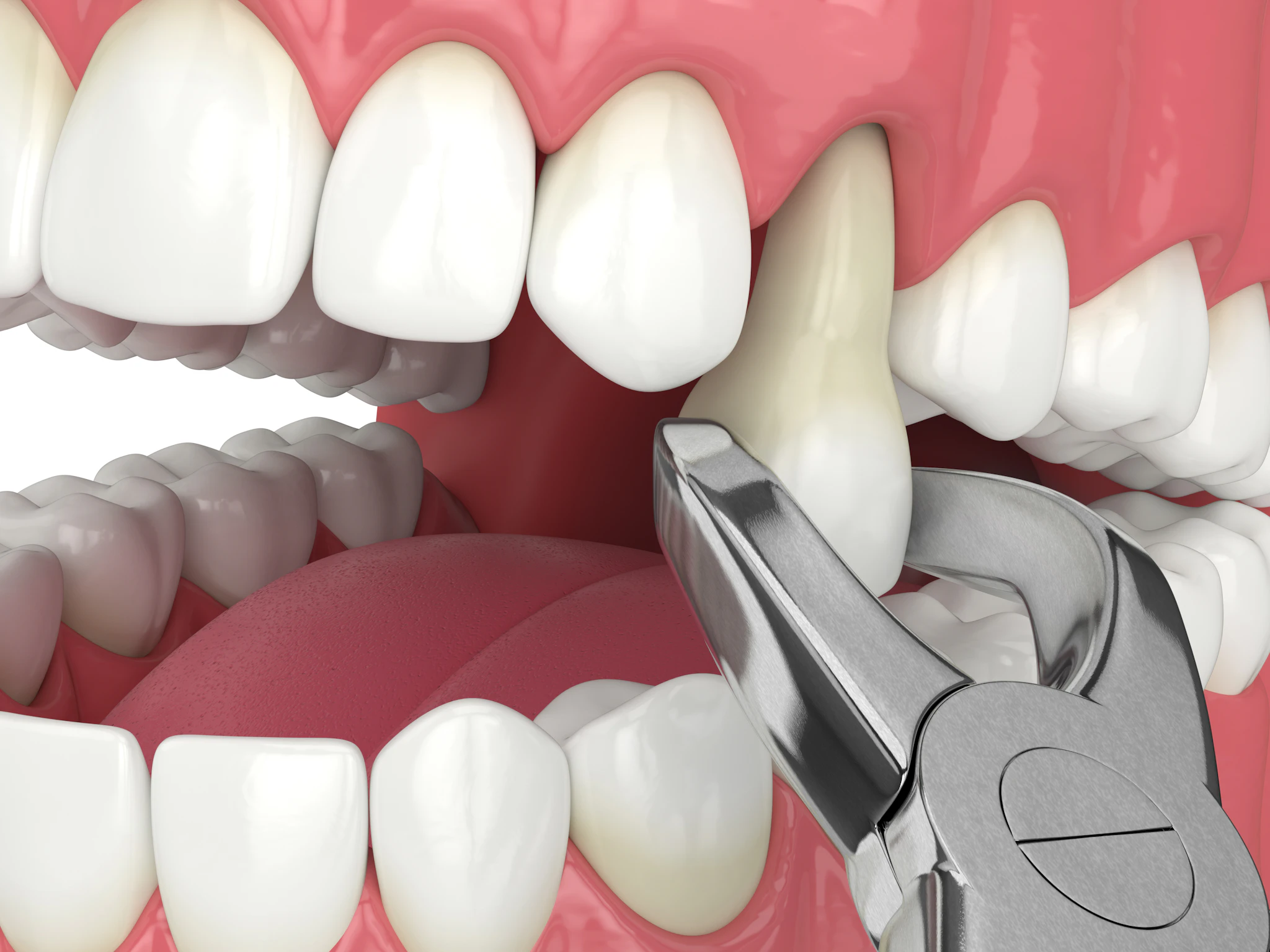 Valrico Oral Maxillofacial Surgeon Office - Advanced Oral Surgery of Tampa
