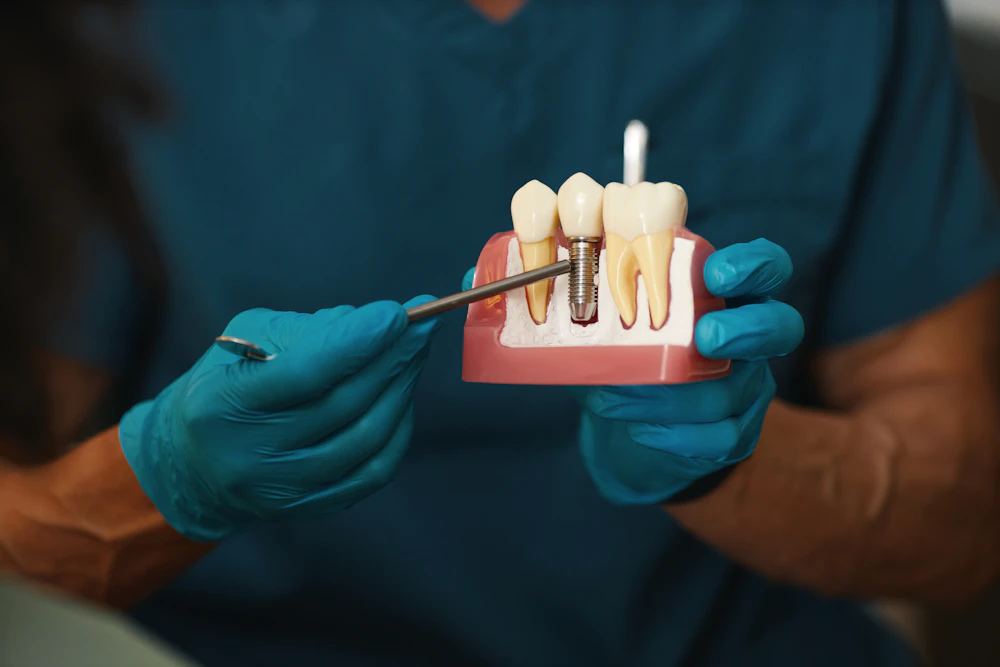 Gloved hands holding dental model demonstrating placement of a single tooth implant