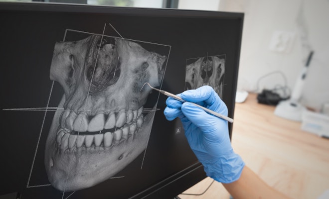 Digital dental x-rays