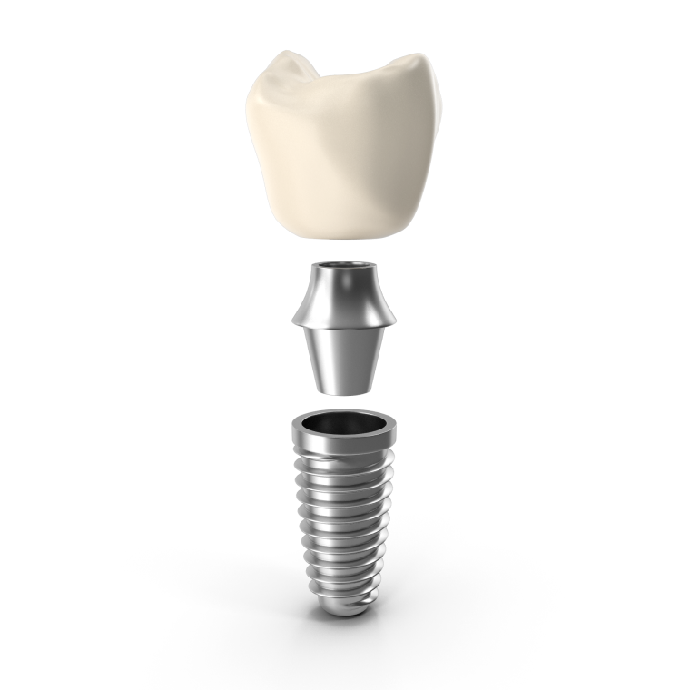 Implant crown