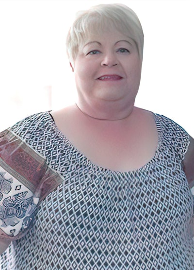 Vision Bariatrics patient before bariatric surgery