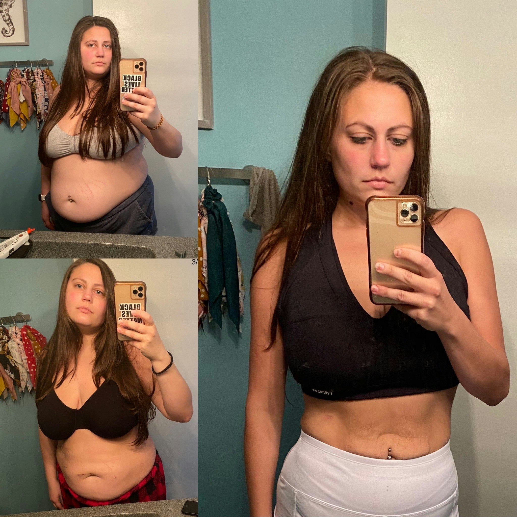 Collage of before and after photos, showing weight loss