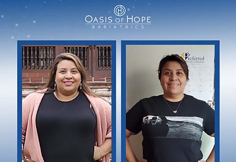 Before and after gastric bypass surgery