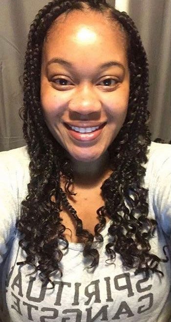 Vision Bariatrics patient after mini gastric sleeve surgery