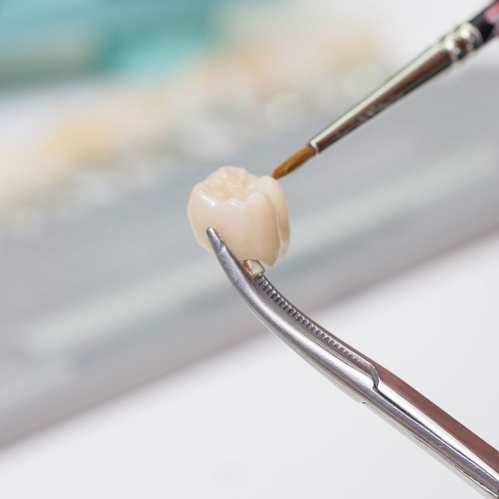 putting the finishing touches on a crown