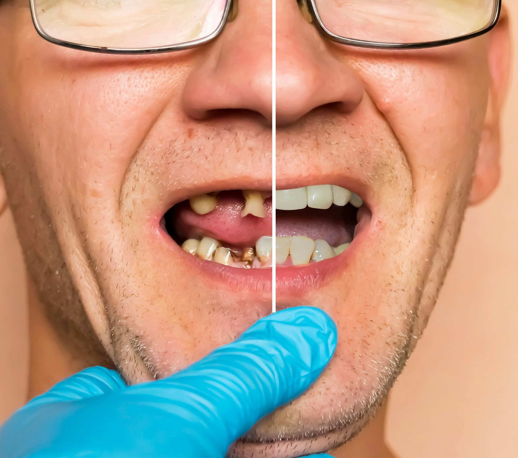 before and after dental care comparison