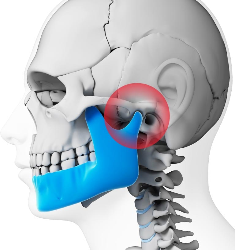 Illustration showing the TMJ