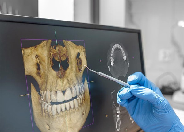 digital maxillofacial x-ray