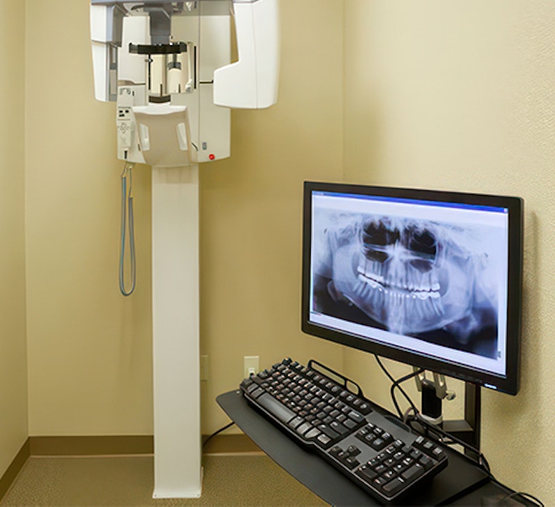 CBCT scanner and monitor