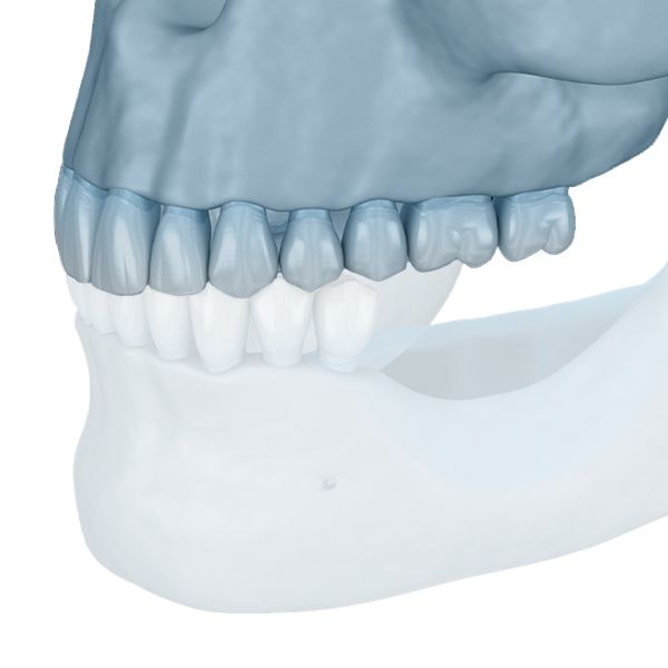 upper jaw