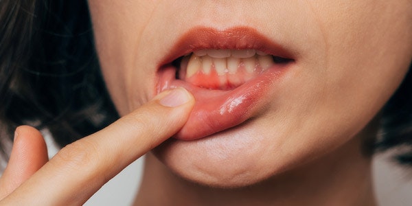 Dental patient with gum disease